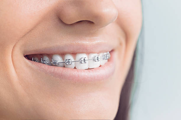 Why Choose Us for Your Dental Needs in Heathrow, FL